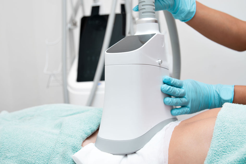 Criolipolisis experiencia